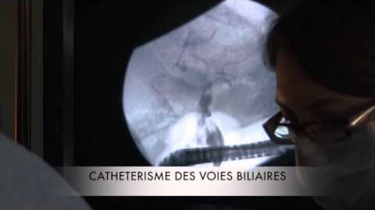 Endoscopie